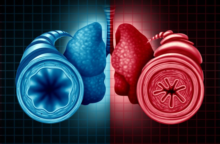 Types of inhalers